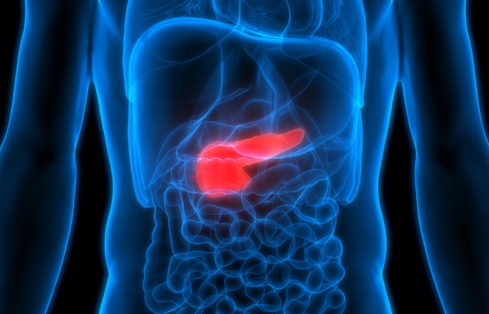 pancreatic cancer