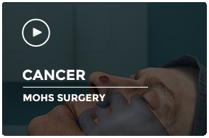 Mohs Surgery