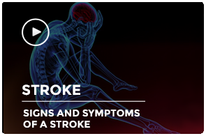 Signs and Symptoms of a Stroke