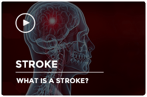 What is a Stroke?