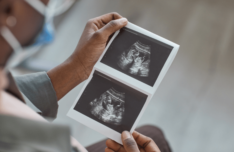  Get the facts about birth defects